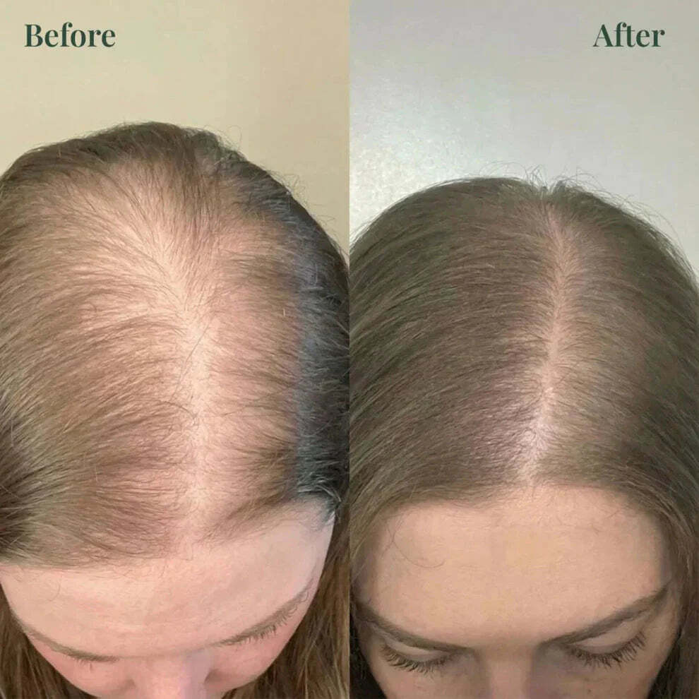 Kerarose Rosemary Shampoo (Unisex)🔥Buy 1 Get 1 Free🔥