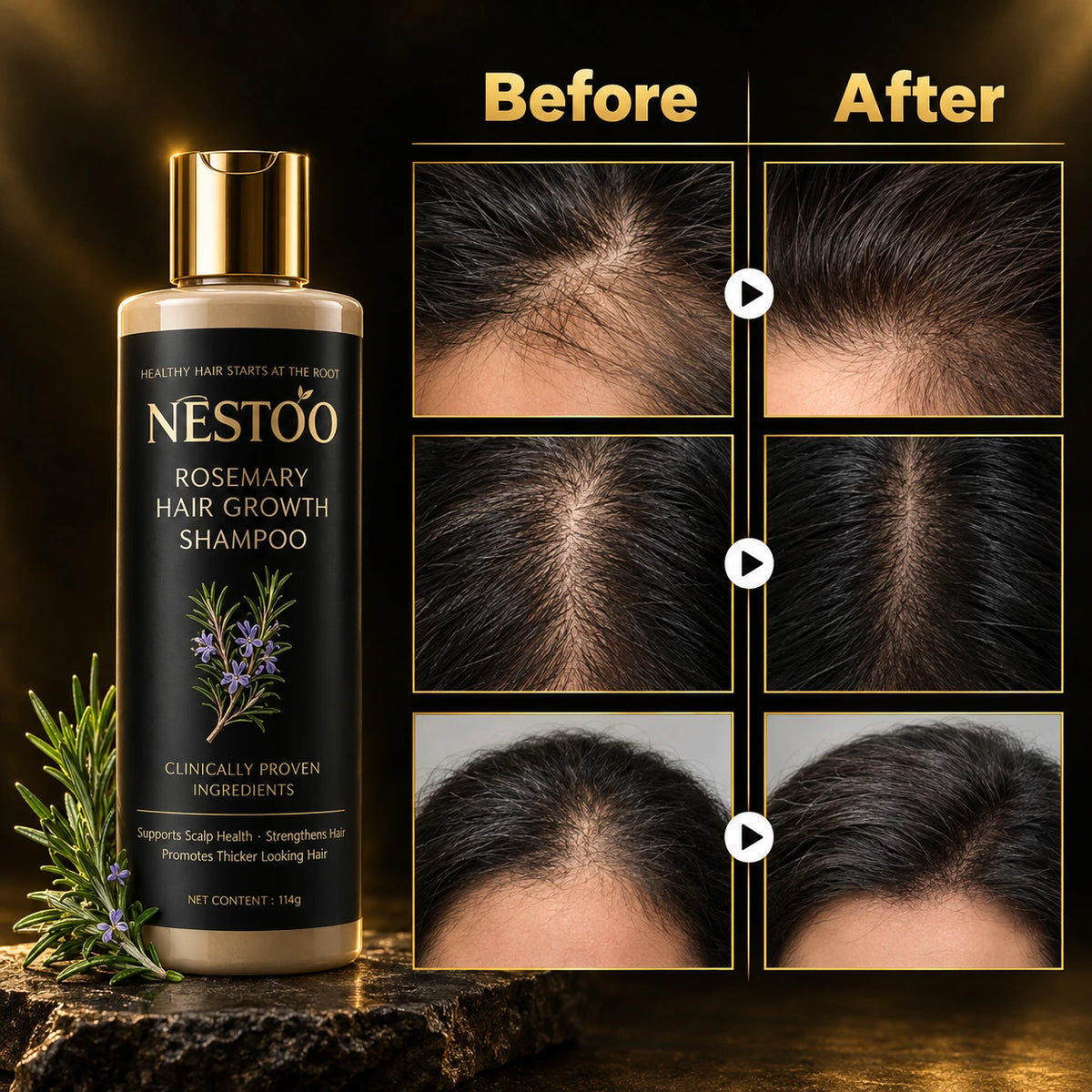 Kerarose Rosemary Shampoo (Unisex)🔥Buy 1 Get 1 Free🔥